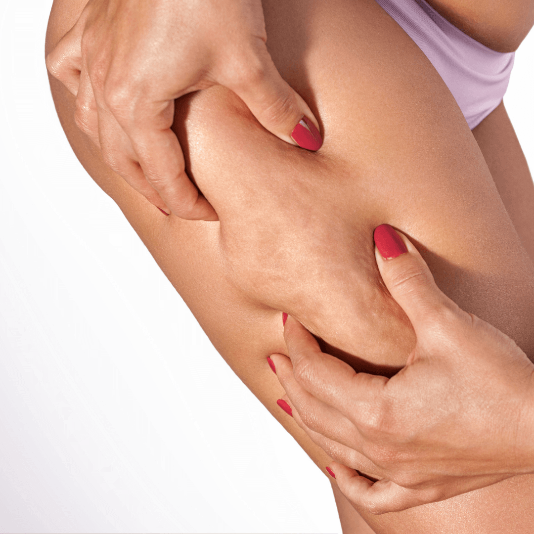 anticellulite massage dubai