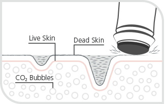 Dubai oxygeneo facial
