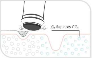 Dubai oxygeneo facial