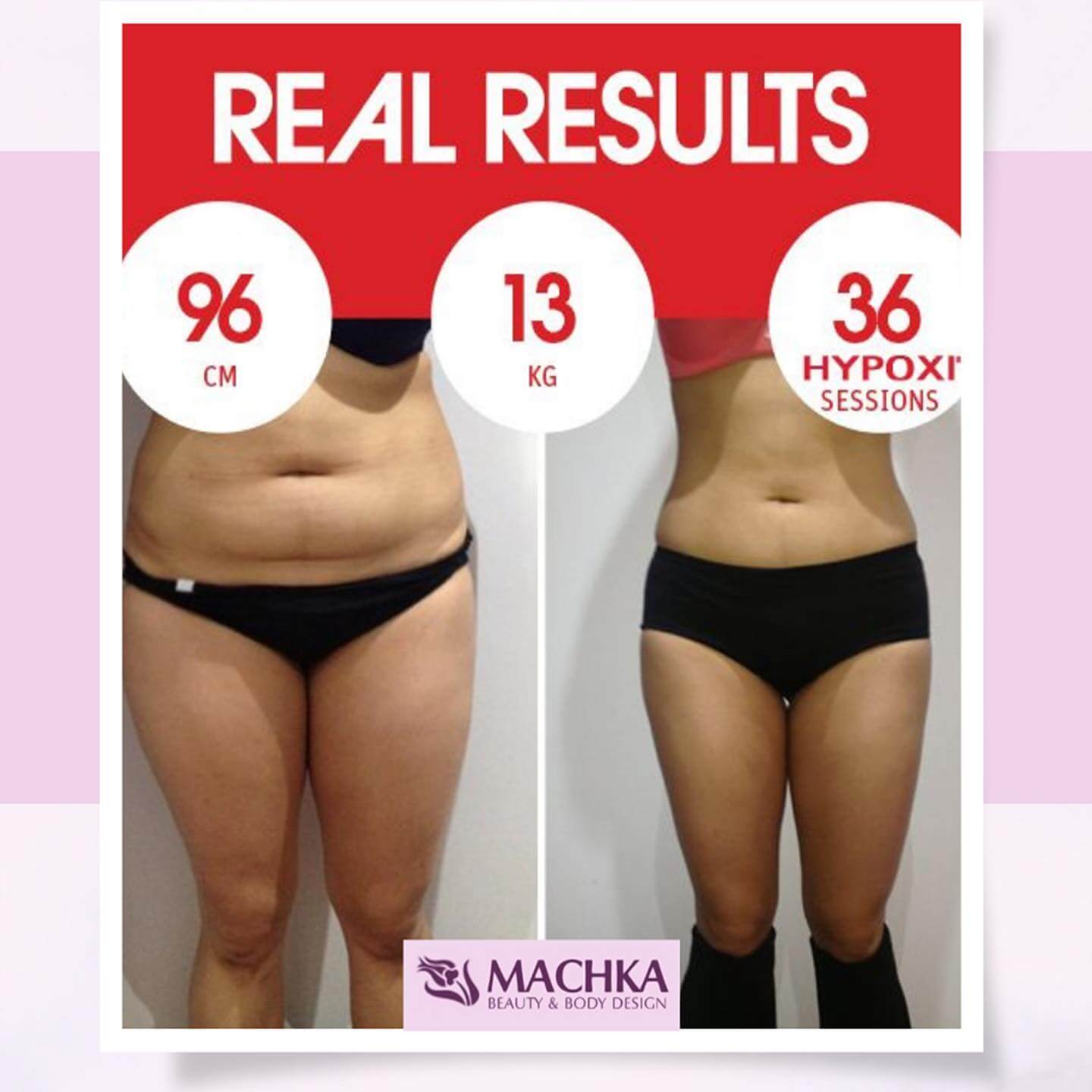 weight loss programs in dubai