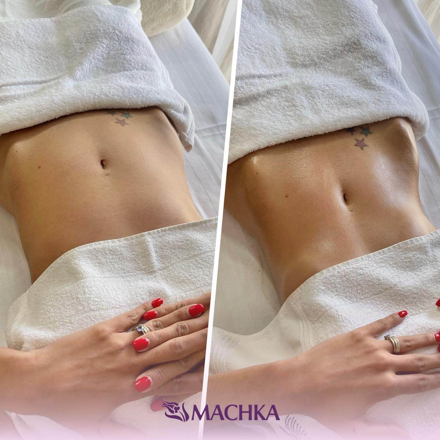 weight loss programs in dubai